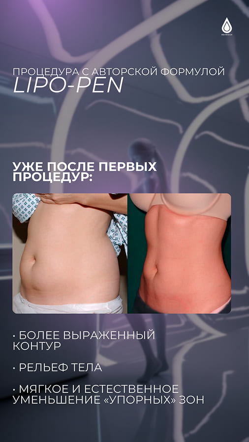 Жировые ловушки