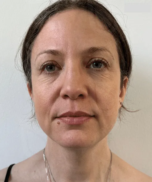 массаж лица