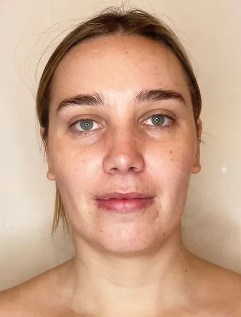 массаж лица 3