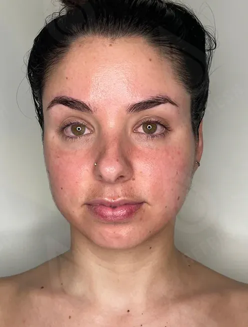 массаж лица 4