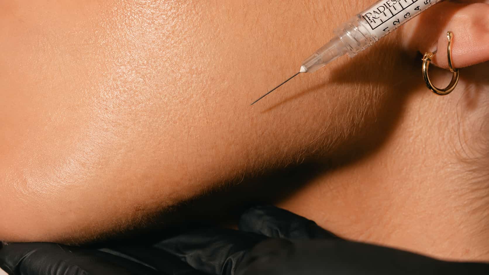 Бейби Ботокс (Baby Botox): искусство естественной молодости