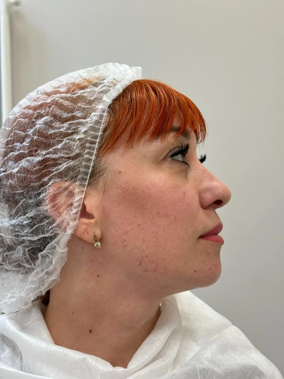 SALMON DNA 2 SALMON DNA 2