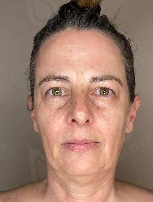 массаж лица 5