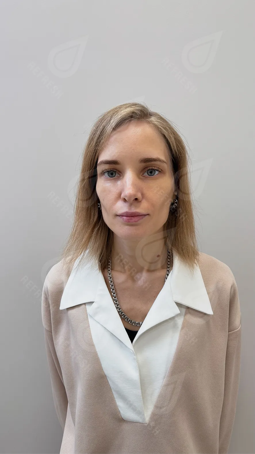 Morpheus-лифтинг 3