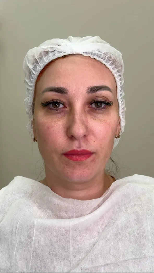 SALMON DNA SALMON DNA