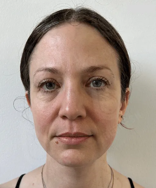 массаж лица