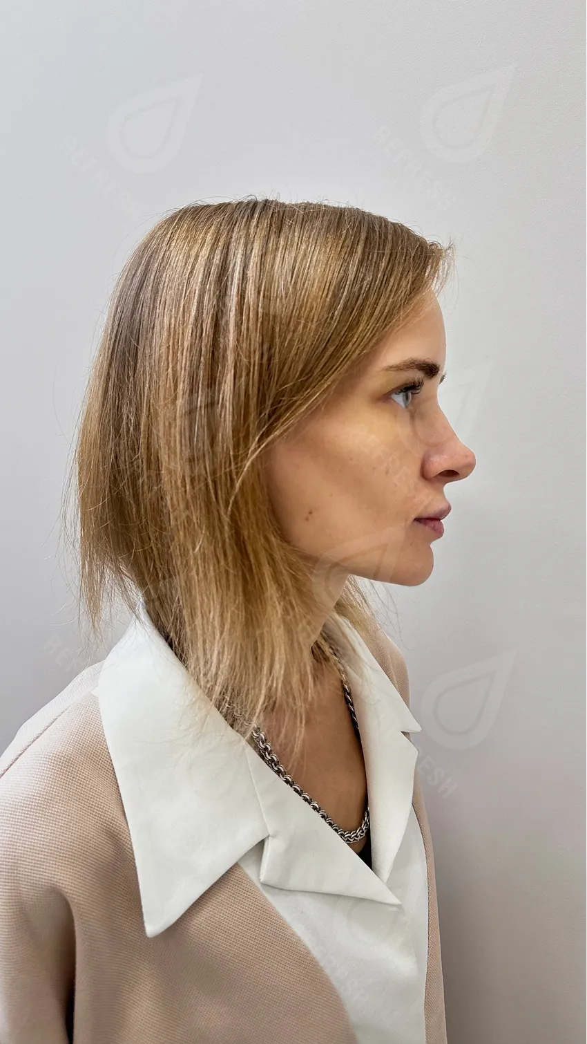 Morpheus-лифтинг 4