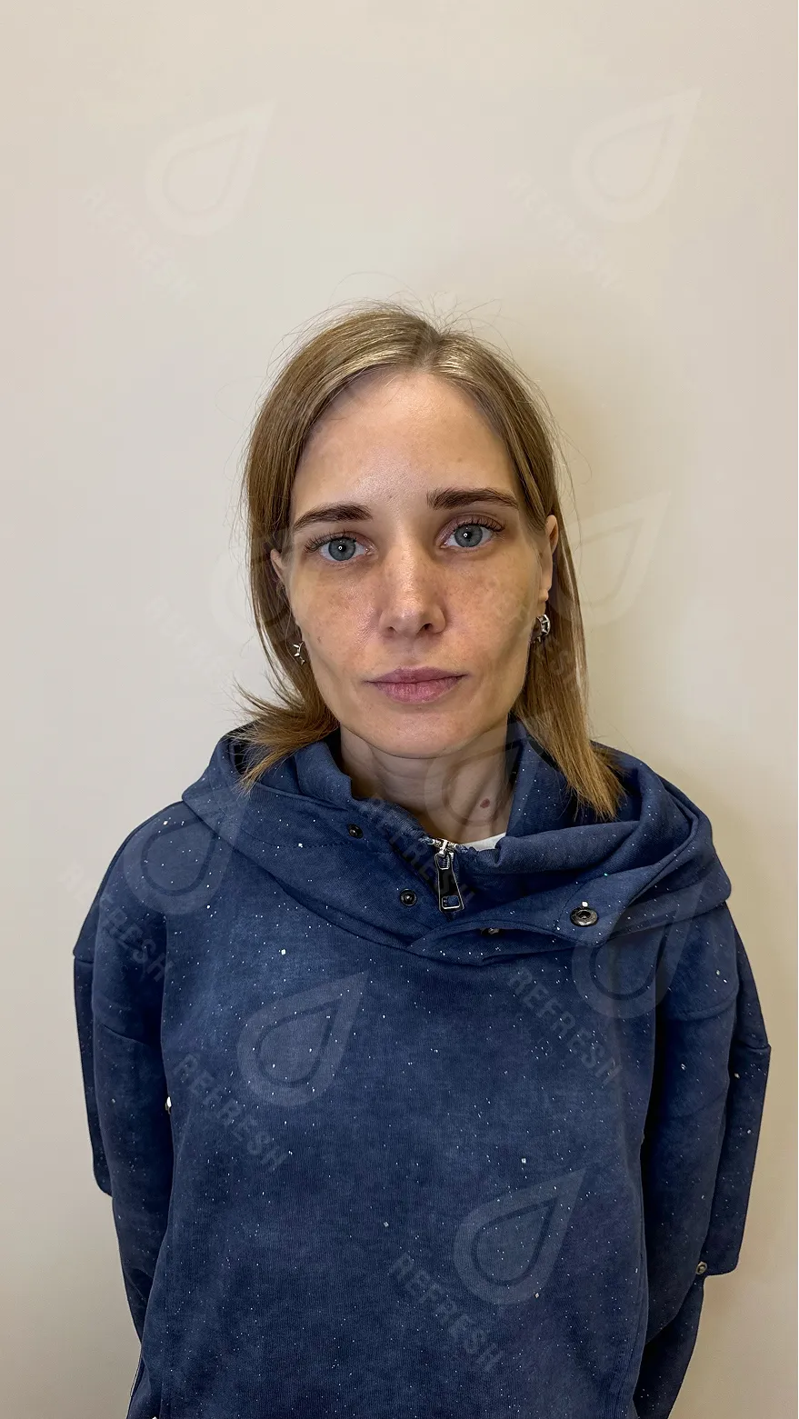 Morpheus-лифтинг 3