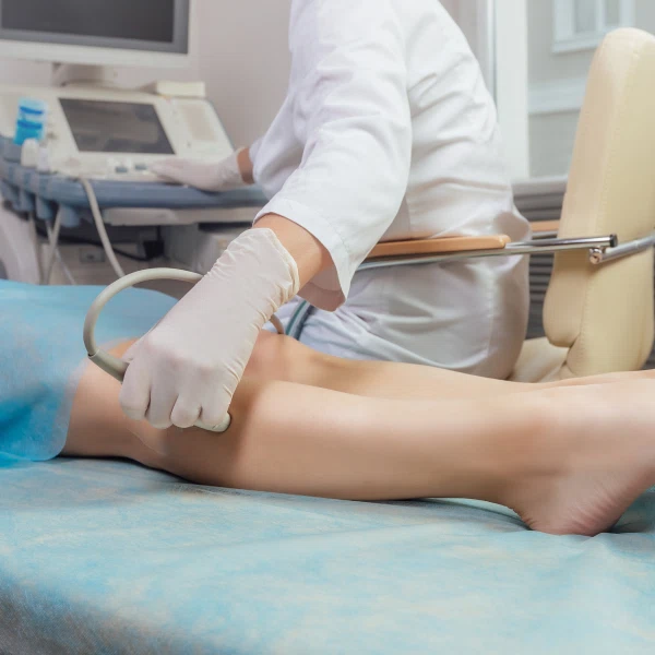 УЗИ вен нижних конечностей с допплерографией