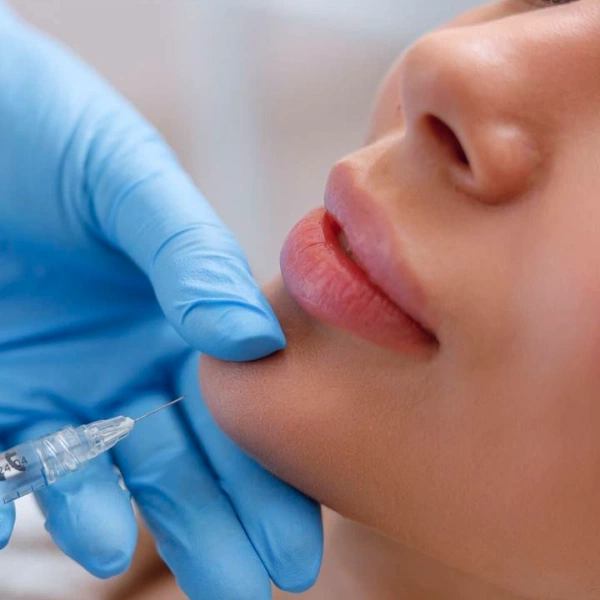 Контурная пластика филлерами