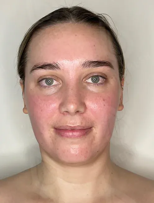 массаж лица 3