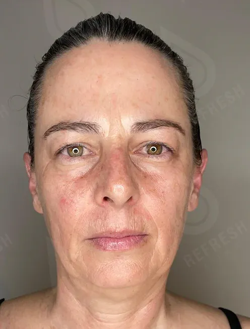 массаж лица 5