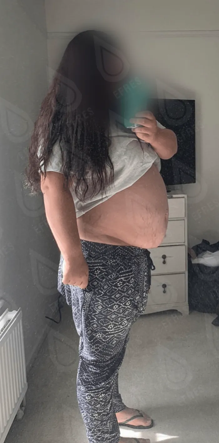 до и после в программы 2