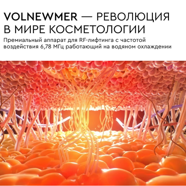 Volnewmer.jpg Volnewmer.jpg