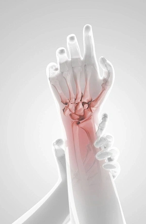 Решение для суставов и связок, которое возвращает движение