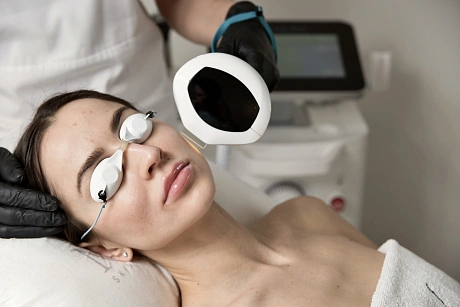 Фотоомоложение Lumecca