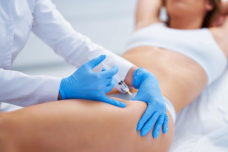 Мезотерапия тела 